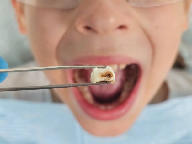 Best Emergency Tooth Extraction  in Whitehall, OH